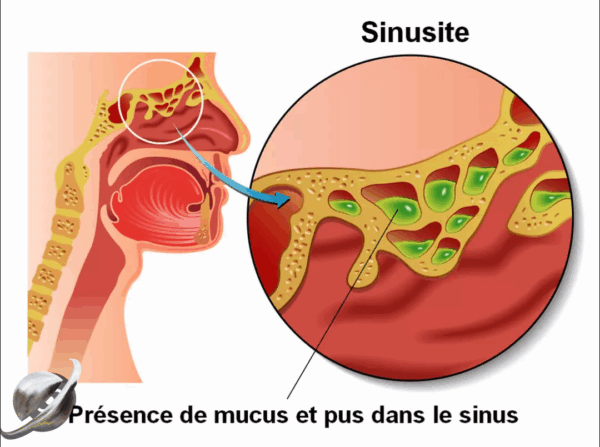 Thé – Image 4